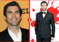 Wes Bentley Teeth