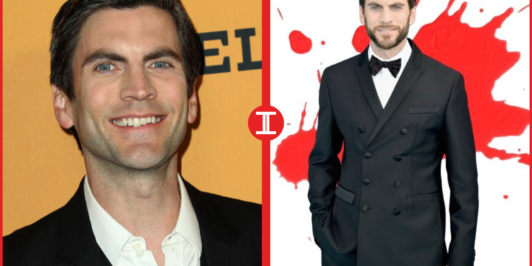 Wes Bentley Teeth