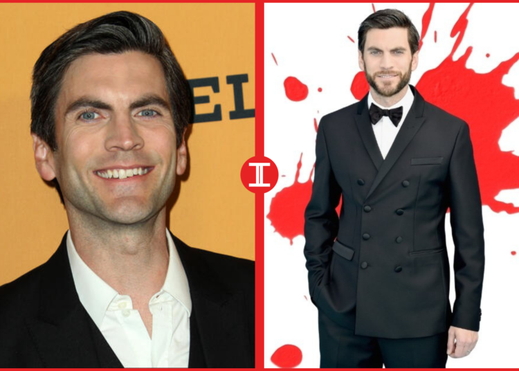 Wes Bentley Teeth