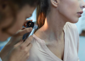 How to Know When to Worry About a Mole and Seek Professional Care