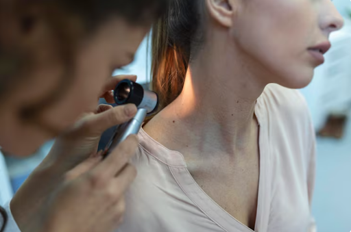 How to Know When to Worry About a Mole and Seek Professional Care