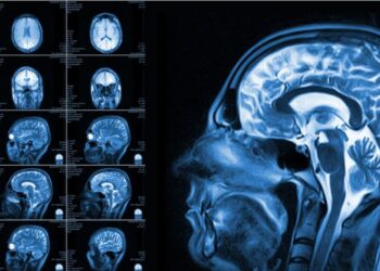 Hidden Brain Injuries