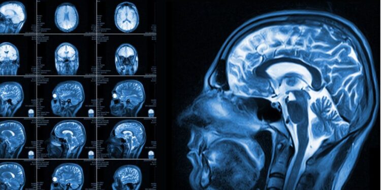 Hidden Brain Injuries