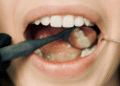 teeth grinding night guard lower hutt