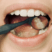 teeth grinding night guard lower hutt